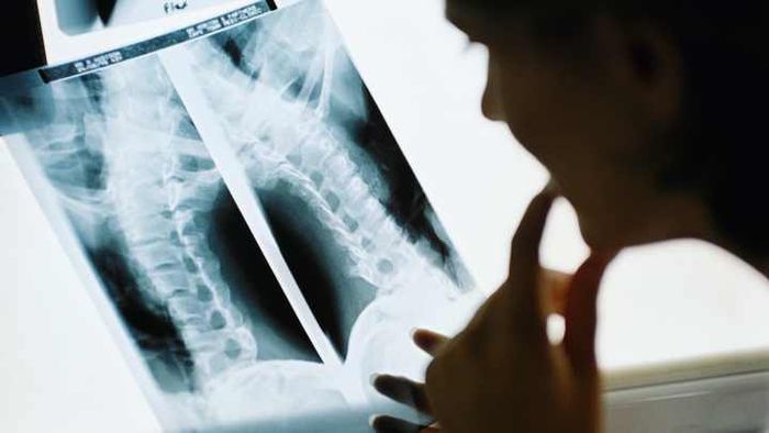 A doctor examines a spinal X-ray.