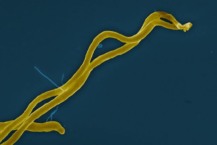 An extreme close-up image of the ‘Borrelia burgdorferi’ spirochete bacterium, which causes Lyme disease.
