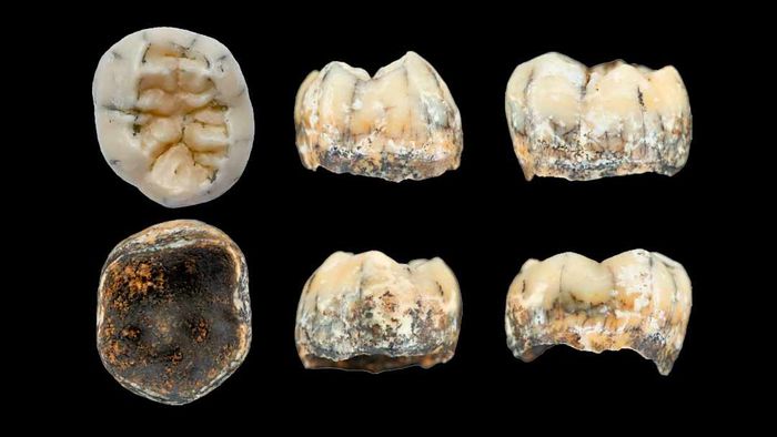 Six views of an ancient tooth, potentially from a Denisovan, found in Laos.