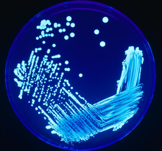 Legionella