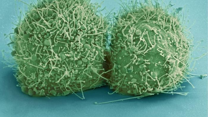 A scanning electron micrograph of freshly divided HeLa cells