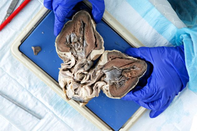 2- body parts