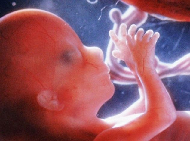 fetus