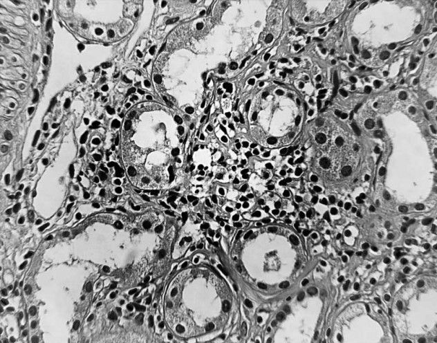 cell_2