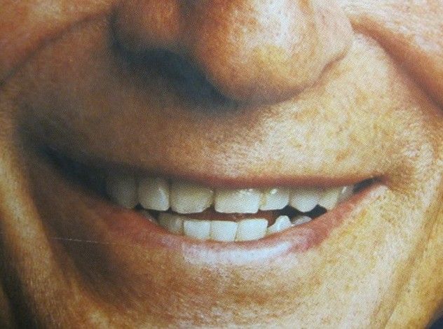 TEETH