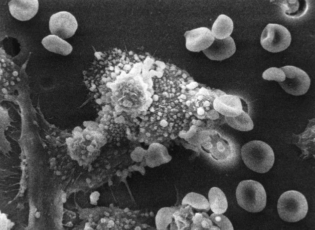 Macs_killing_cancer_cell