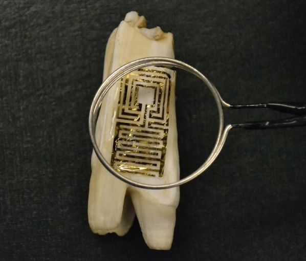 Graphene Tooth Sensor