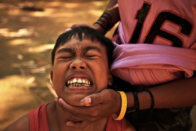 Child-In-Pain-During-Circumsision