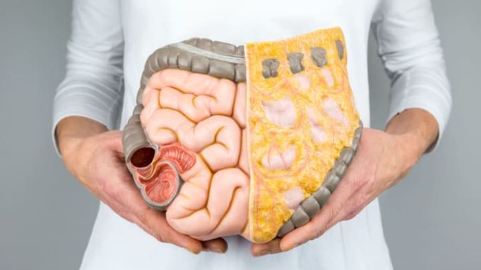 iStock