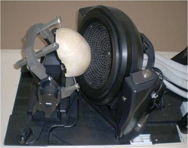 Pic1