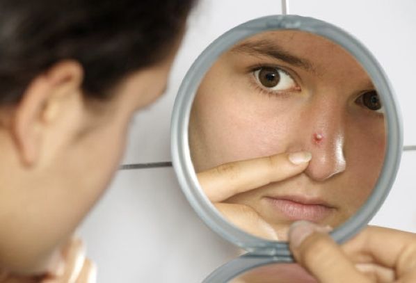 Photolibrary Rf Photo Of Girl Looking At Pimple