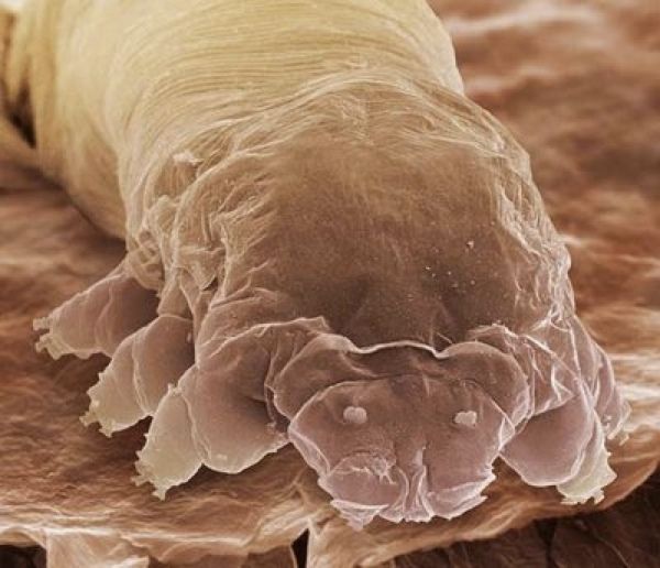 Eyelash Mite