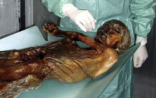 Otzi the Iceman