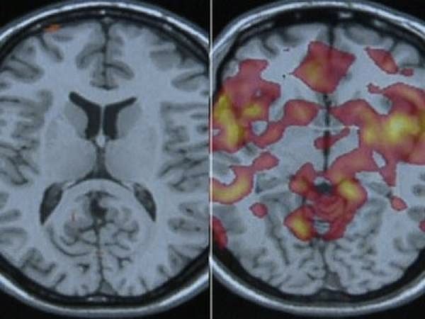 Brain Scan Lie Detector