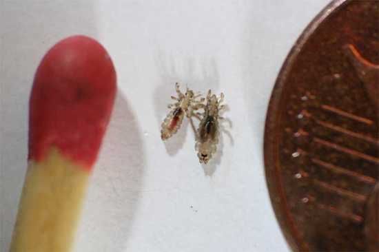 Head Lice