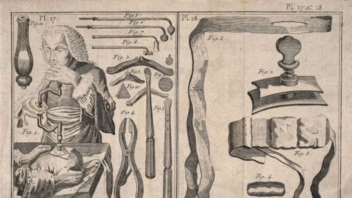 Wellcome Collection, CC-BY-4.0, Wikimedia Commons