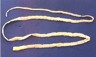 Tapeworm