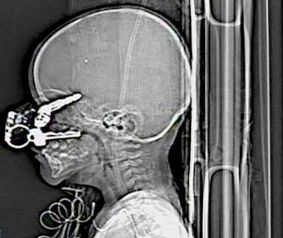 Unreal-X-Ray-Pictures07.Jpg