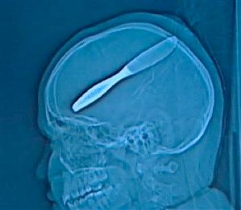 08416-Xray-Hmed-6A.Standard.Jpg