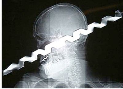 Unreal-X-Ray-Pictures04.Jpg