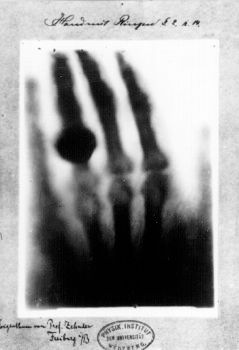 Anna Berthe Roentgen