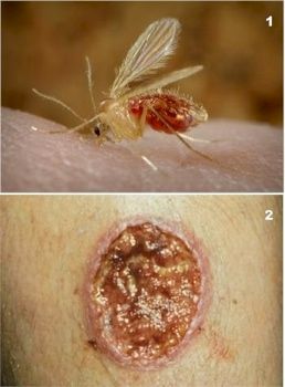 Leishmaniasis-2Panel