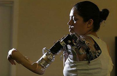 Bionic Arm