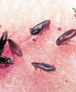 Fleas