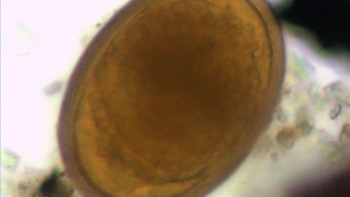 An egg of a roundworm