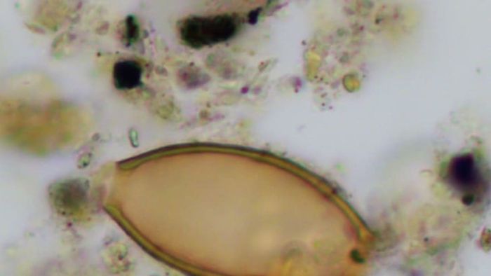 An egg of a whipworm