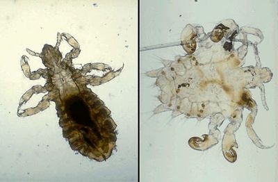 Lice