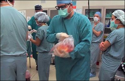 Heart Transplant