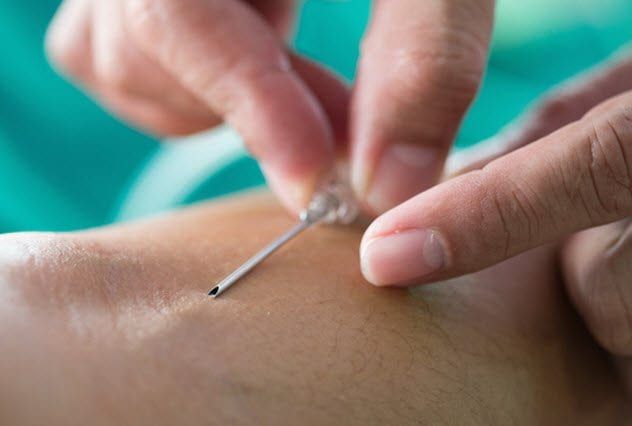 7b-blood-extraction-527011603