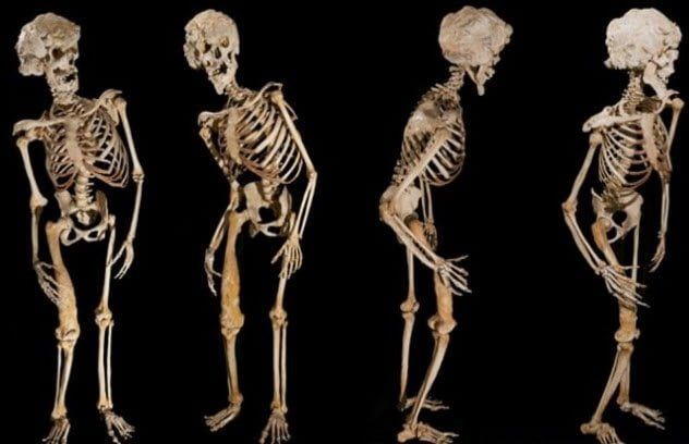 2-elephant-man-skeleton