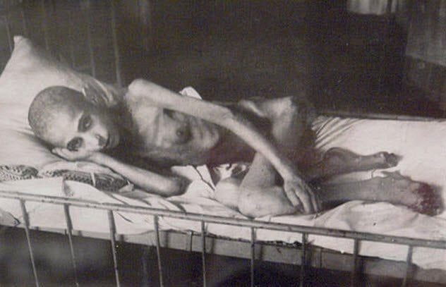 3a-starvation-victim-leningrad-siege