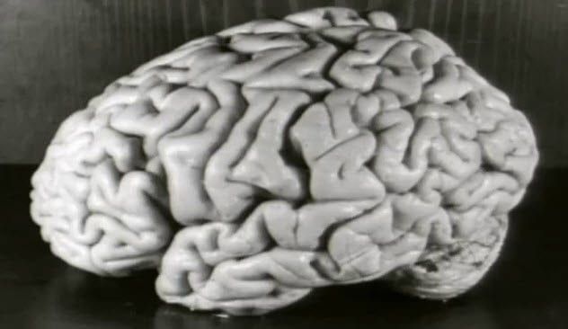 1-einstein-brain