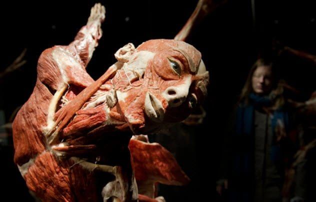 7-plastinated-body