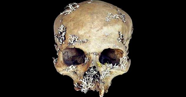 1mossyskull
