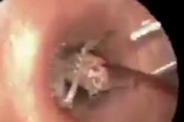 ear-cricket-india