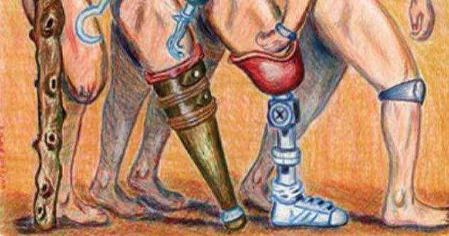 4-prosthetic-legs-feet