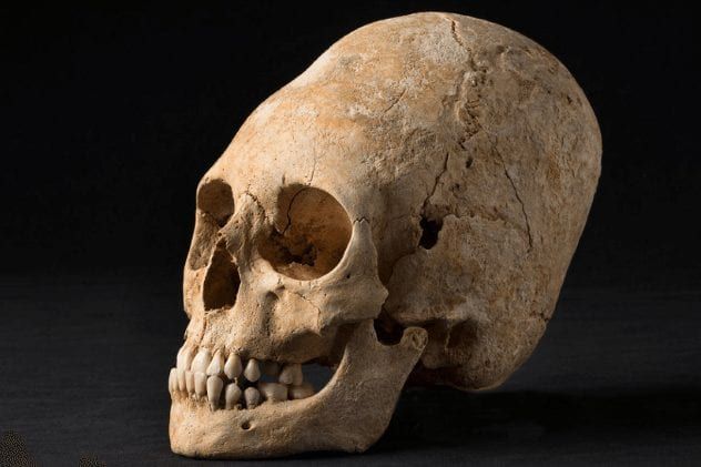 alsatian-noblewoman-skull