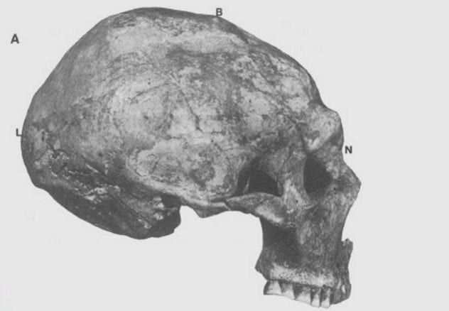 shanidar-skull