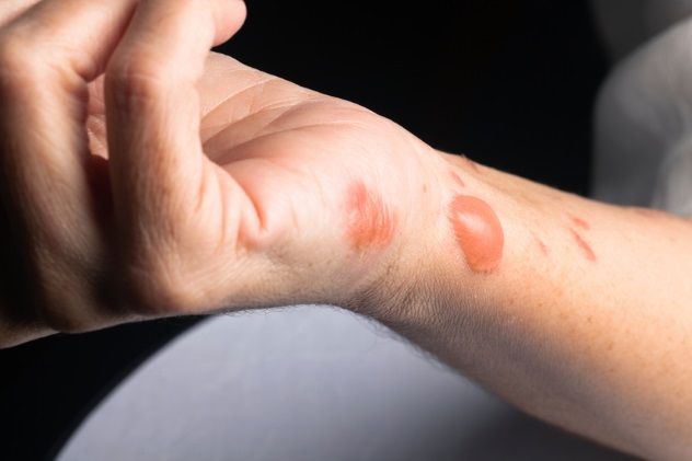 iStock_15610033_SMALL