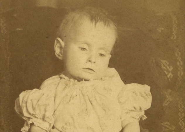 Deceased Baby