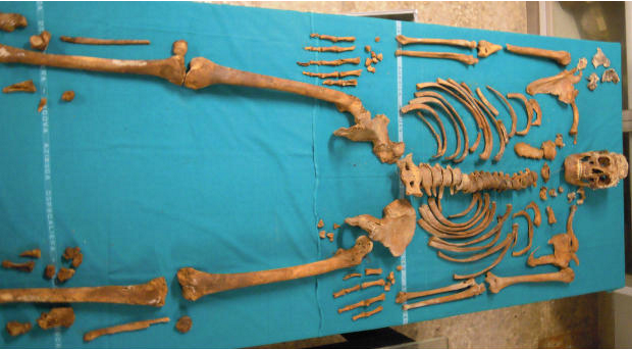 Gaspare Pacchierotti Skeleton