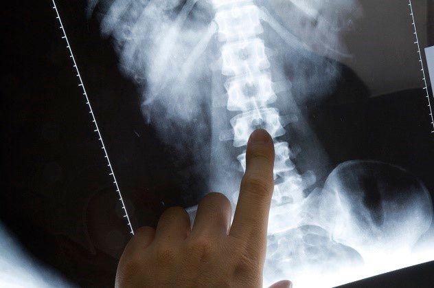 x-ray image