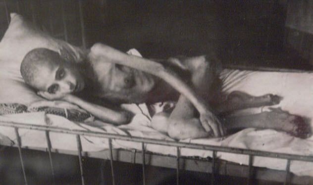 6-starvation-victim-darken