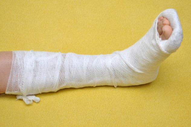 broken foot