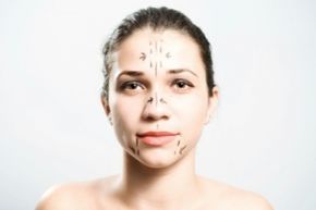 Teenage girl preparing for a surgical procedure