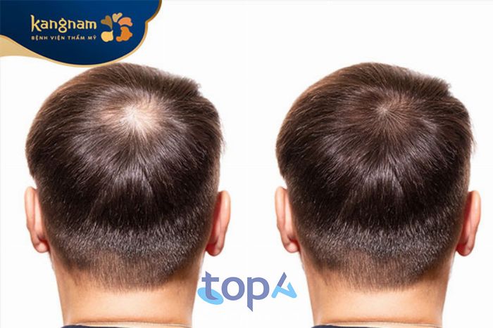 Bệnh Viện Thẩm Mỹ Kangnam, Hà Nội